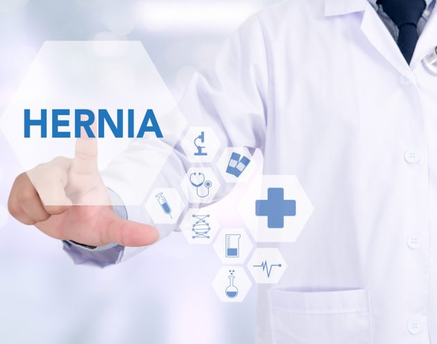 Hernia or Surgical Mesh Injuries