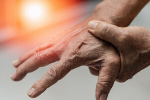 The Difference between Rheumatoid Arthritis and Osteoarthritis